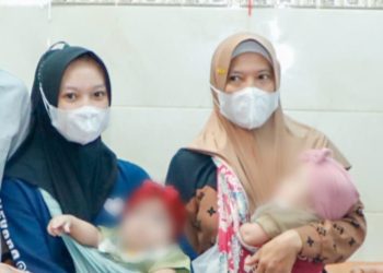 Kembar Siam Azizah Syafa dan Azzahra Syafa sebelum dibawa pulang ke Ngawi.